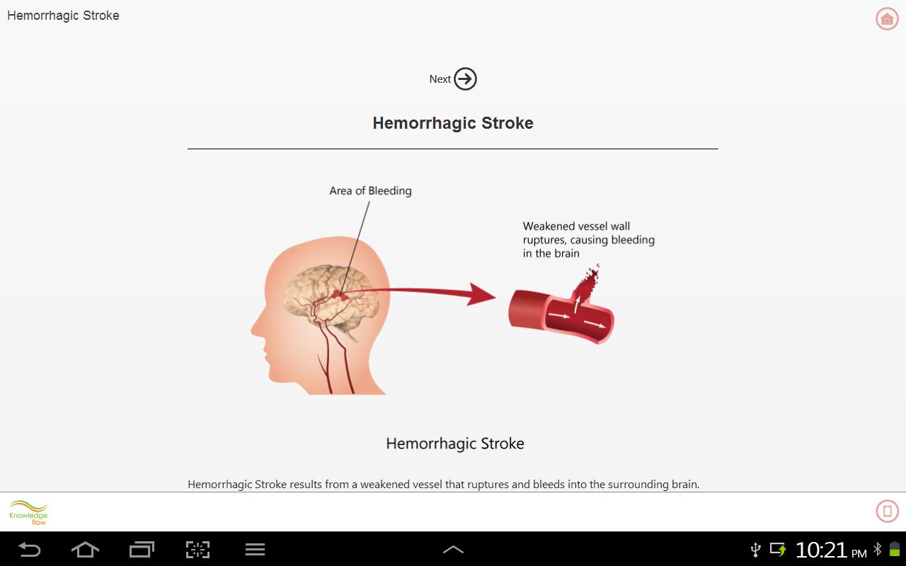 Brain Stroke