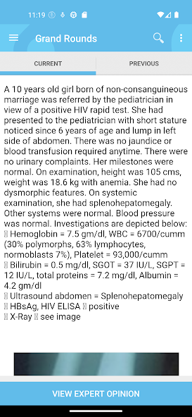 HIV In Children