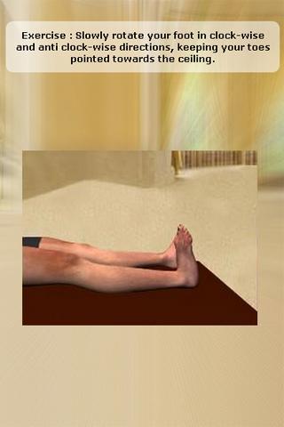 Plantar Fasciitis