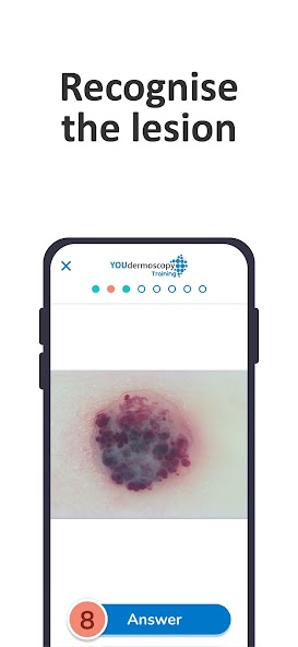 YOUdermoscopy