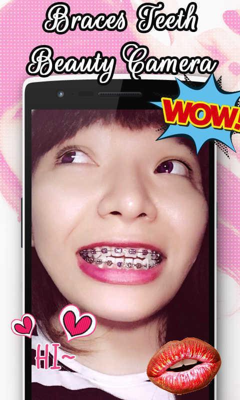 Braces Teeth Beauty Camera