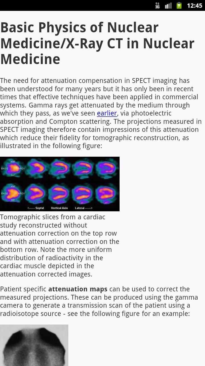 Physics of Nuclear Medicine