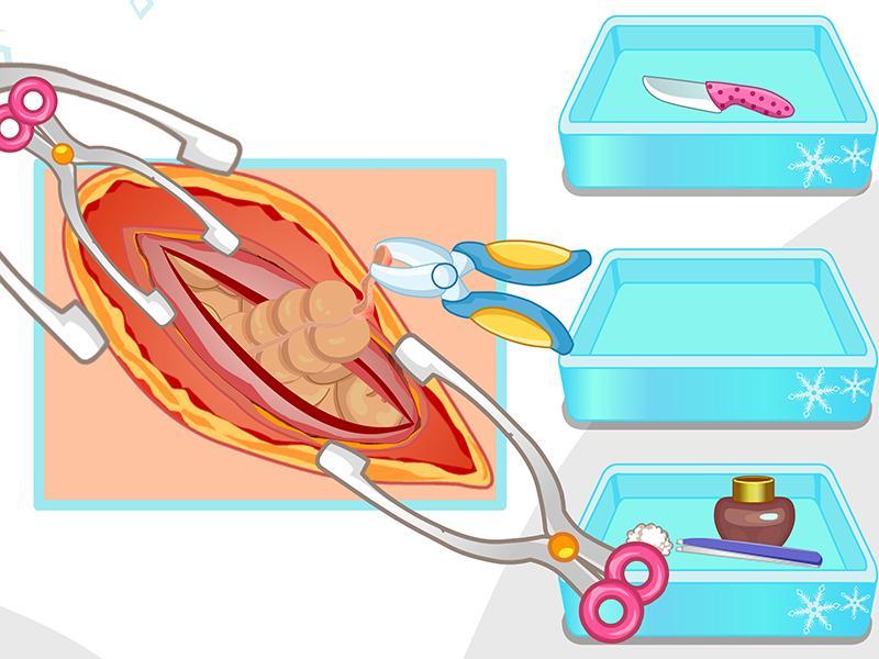 Girl appendicitis surgery game