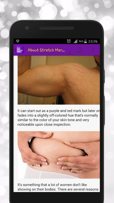 Get Rid of Body Stretch Marks