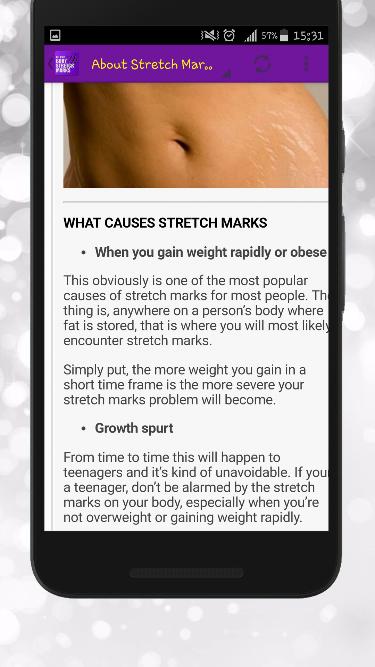 Get Rid of Body Stretch Marks