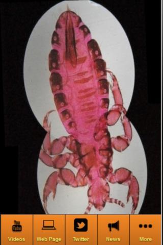 Get Rid Of Head Lice