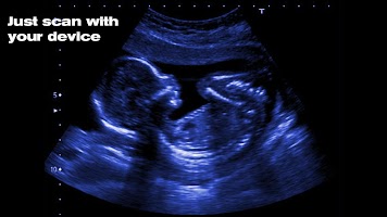 X-Ray Simulator Pregnant Joke